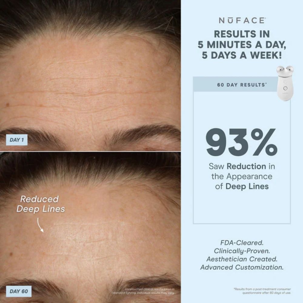 Nuface Trinity+ Smart Advanced Facial Toning Kit - Image 4